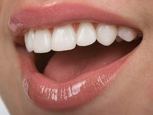 セラミックで白くて美しい歯を実現！